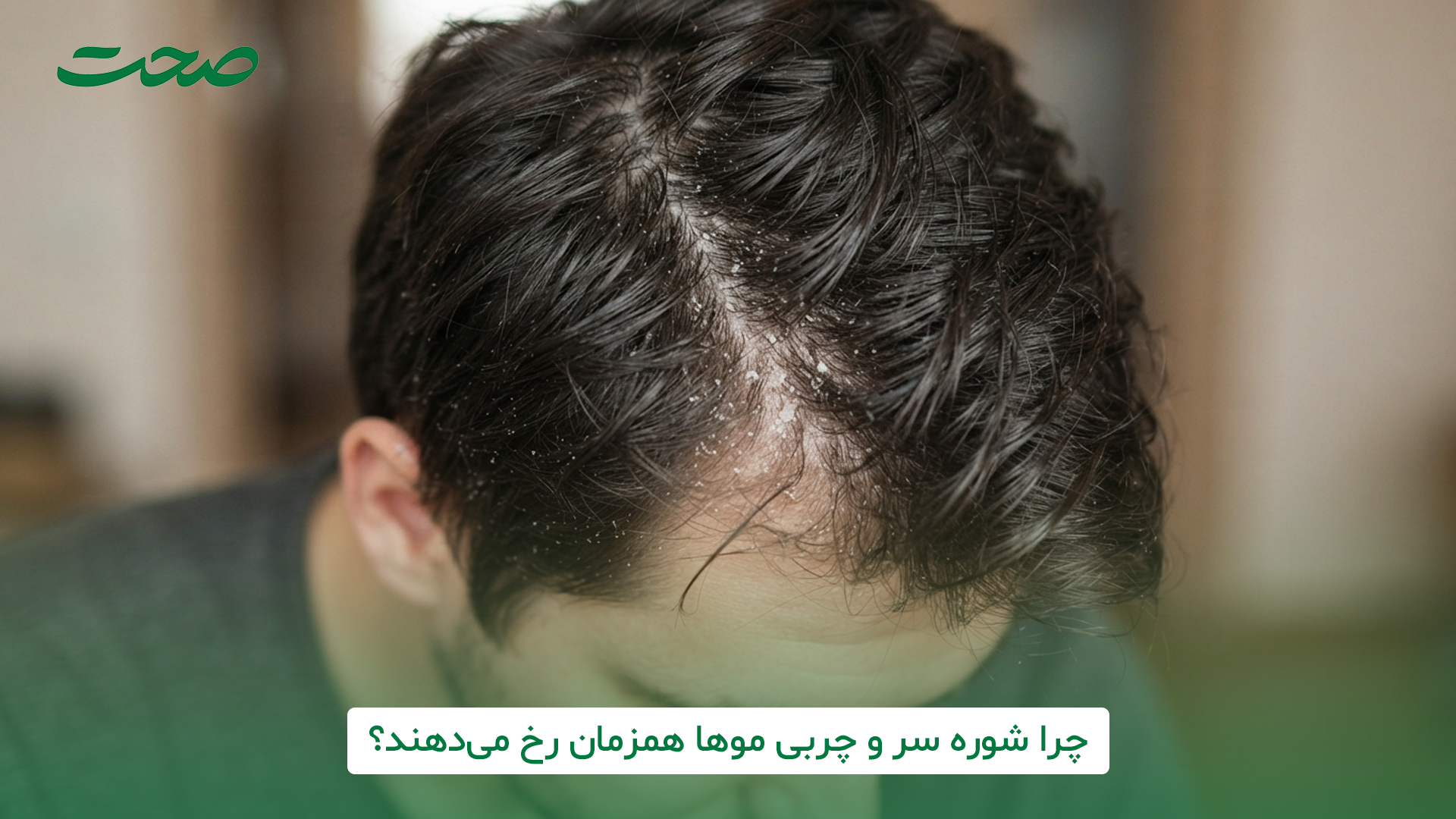 شوره سر اغلب ناشی از تکثیر قارچ «مالاسزیا» است که از چربی (سبوم) پوست سر تغذیه میکند؛ بنابراین هرچه ترشح سبوم بیشتر باشد، این قارچ رشد سریعتری داشته و با تحریک پوست سر، باعث التهاب و پوستهریزی میشود. در واقع چربی بیشازحد، بستری ایدهآل و محرک برای فعالیت قارچهای عامل شوره فراهم میکند که این دو مشکل را همزمان تشدید میسازد. چرا شوره سر و چربی موها همزمان رخ میدهند؟